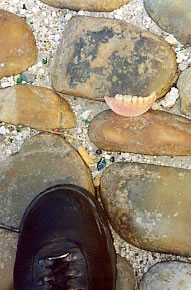 The mysterious denture of Avignon!